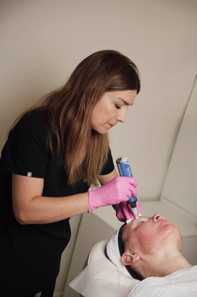 Microneedling