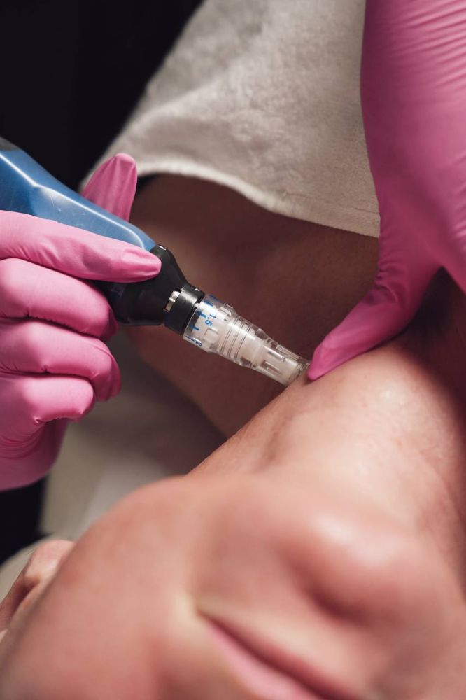 Precision Treatment
